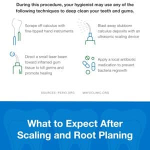 scaling-and-root-planing-gum-disease-treatment-embed