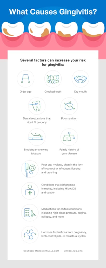 what is gingivitis and how treat it x